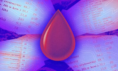 Decoding Your Bloodwork: The Promise and Peril of AI-Powered Analysis